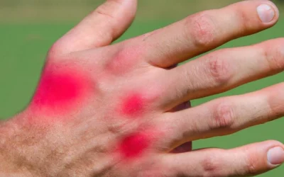 4 tips to avoid hand pain after exercise